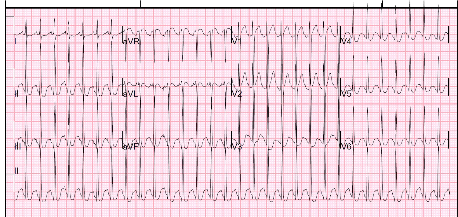 値下げ可能　Advances in Electrocardiology 2004 Electrocardiography for Healthcare Professionals: 9780078020674