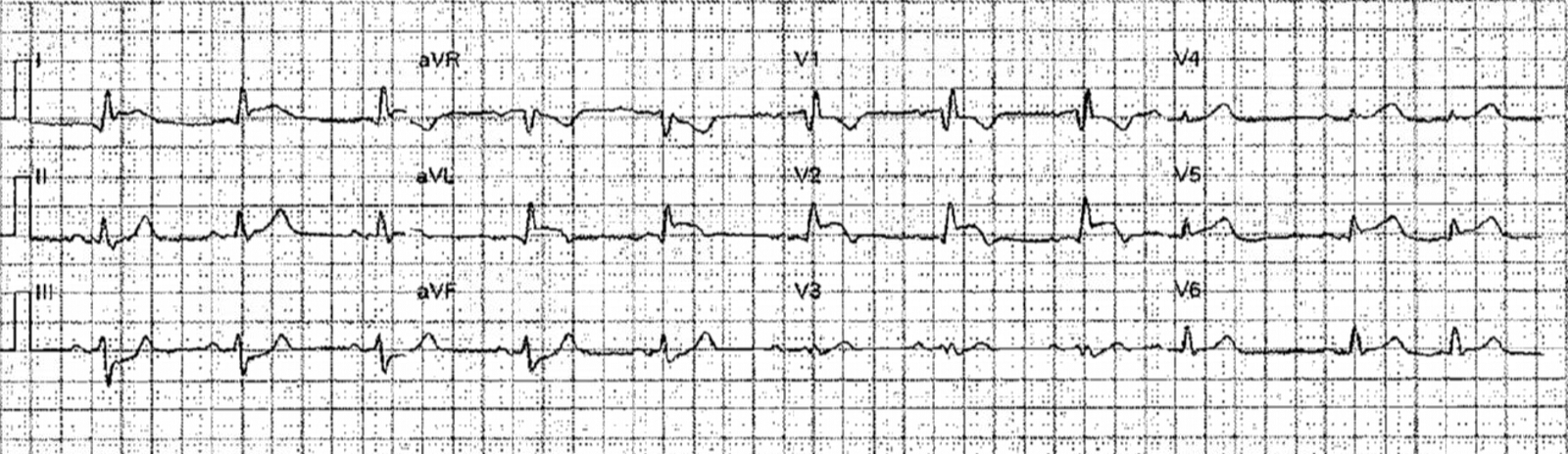 A very elderly woman with sudden severe chest pain radiating to her ...